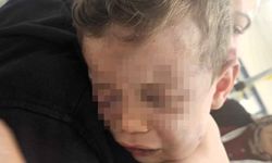 Vahşeti yaşayan 2 yaşındaki bebek hastanelik oldu