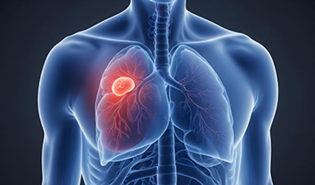 Akciğer Kanserinde Farkındalık Hayat Kurtarıyor