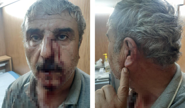 Denizli'de Mesai Tartışması Karakolda Bitti