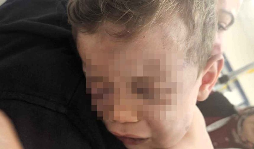 Vahşeti yaşayan 2 yaşındaki bebek hastanelik oldu