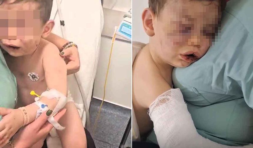 Darp sonucu hastanelik olan bebek devlet korumasına alınacak