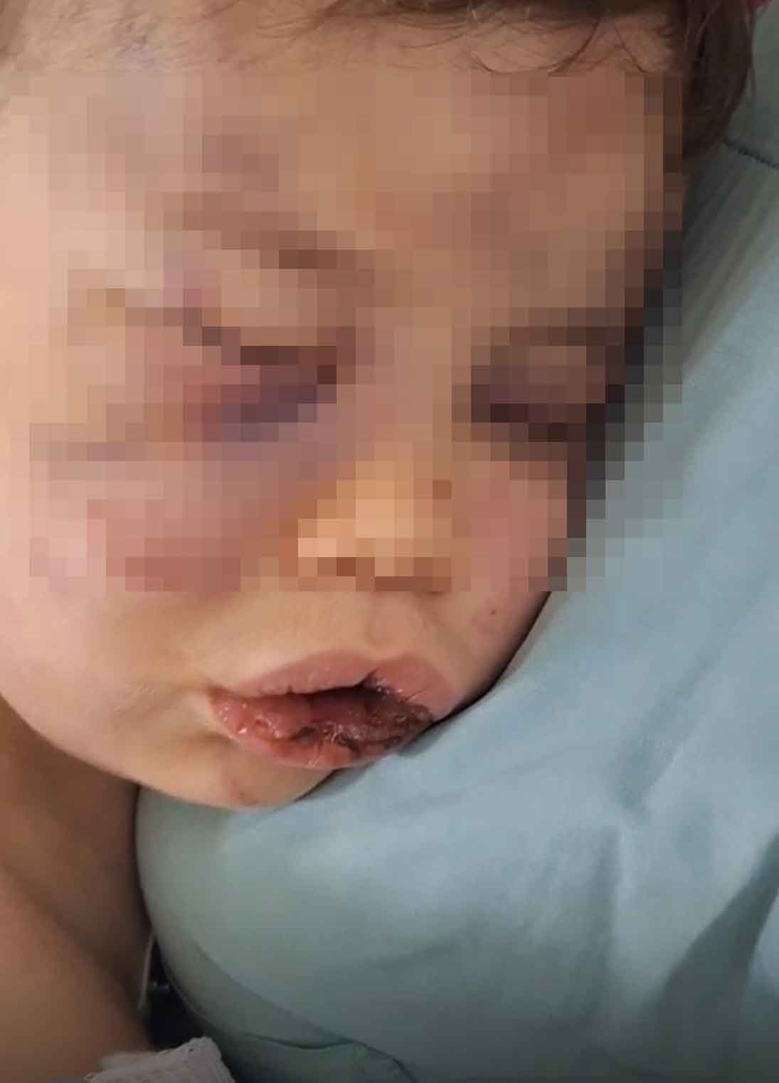 Denizli Bebek Darp Hastanelik Oldu1